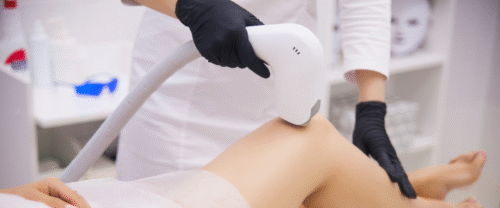 Laser Hair Reduction