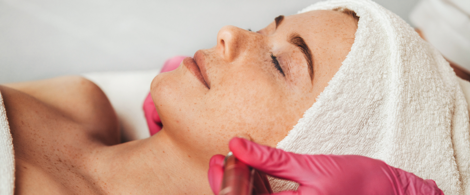 Anti Pigmentation Treatment
