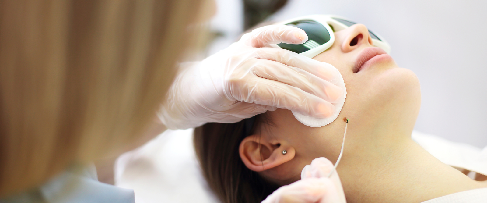 Tag Removal Treatment