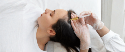 Hair Mesotherapy Treatment in Mira Road