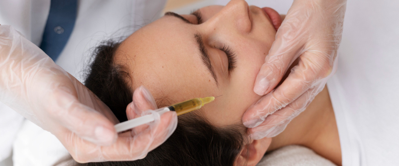 PRP facial treatment in Mira Road
