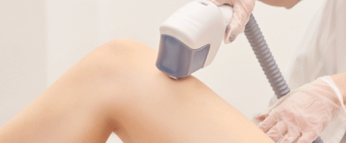 laser hair removal in Mira Road