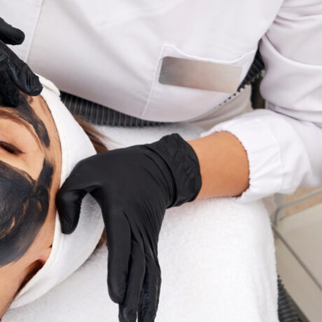 Carbon Laser Facial treatment for oily skin at Purple Aesthetic Center in Mira Road