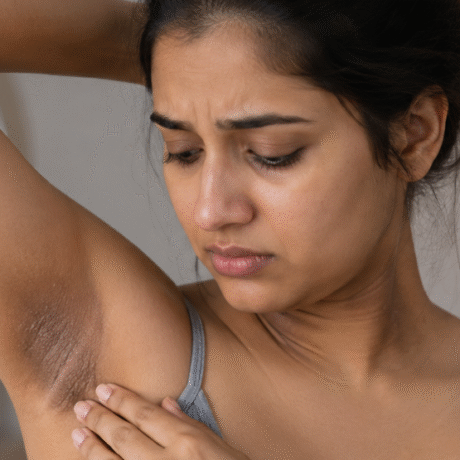 Dark Neck and Underarms: Causes and Treatment Options