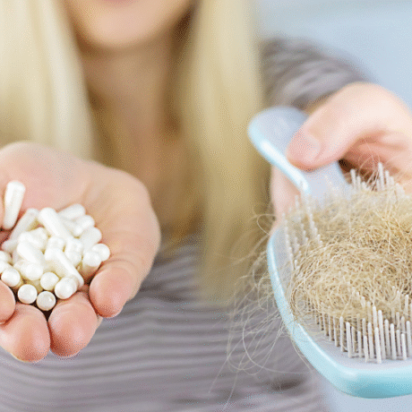 Hair Falling Out Even After Taking Vitamins