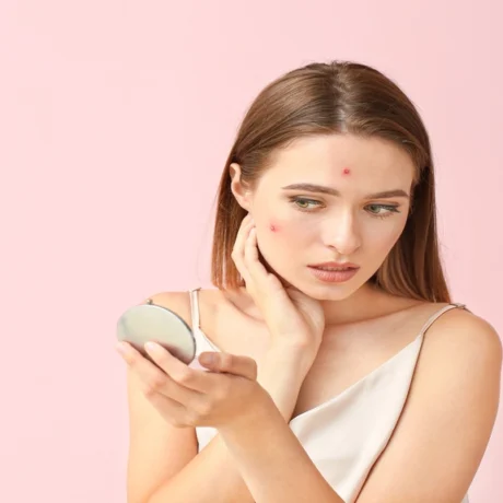 Acne treatment for persistent acne despite using skincare products
